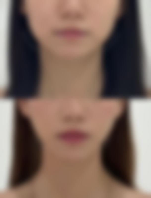 广西 南宁英和医疗美容门诊正规吗？看资质