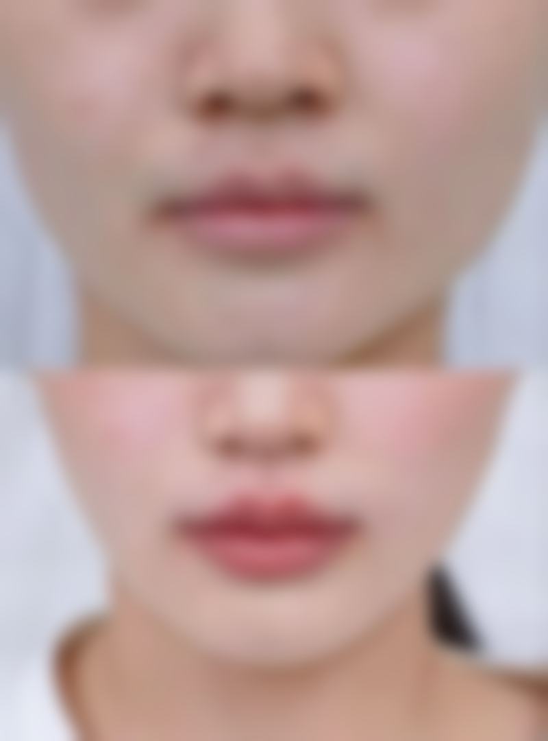 东莞格美雅韵医疗美容门诊部实例参考