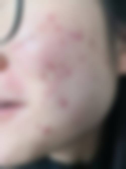 延安大学咸阳整形医院(原二十局医院)实例参考