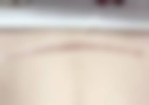 周口烧伤医院医学美容科地址及到院路线