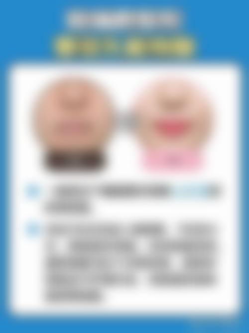 安新县美龄整形医院怎么预约?