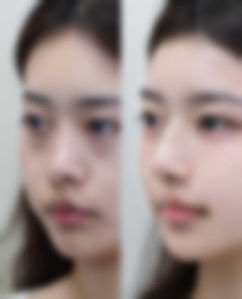 天津市河西区缔美医疗美容诊所价格表（仅供参考）