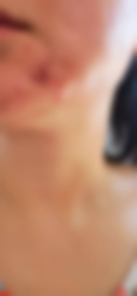 包头军大皮肤病医院价格表（仅供参考）