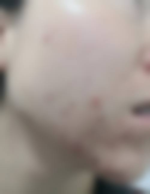 包头军大皮肤病医院正规吗？看资质