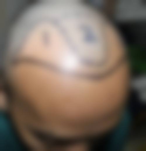 包头军大皮肤病医院实例参考