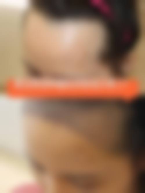 深圳精微植发医院医生团队