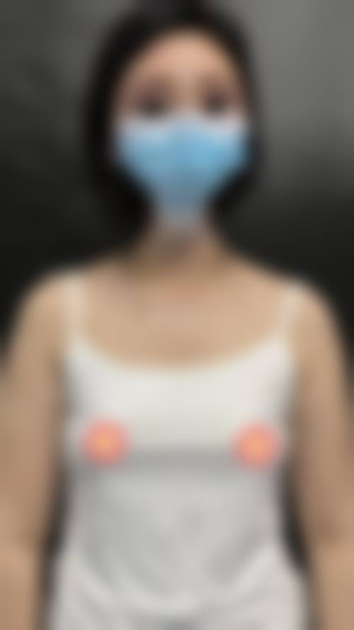 大连王仁东整形医疗美容诊所实例参考