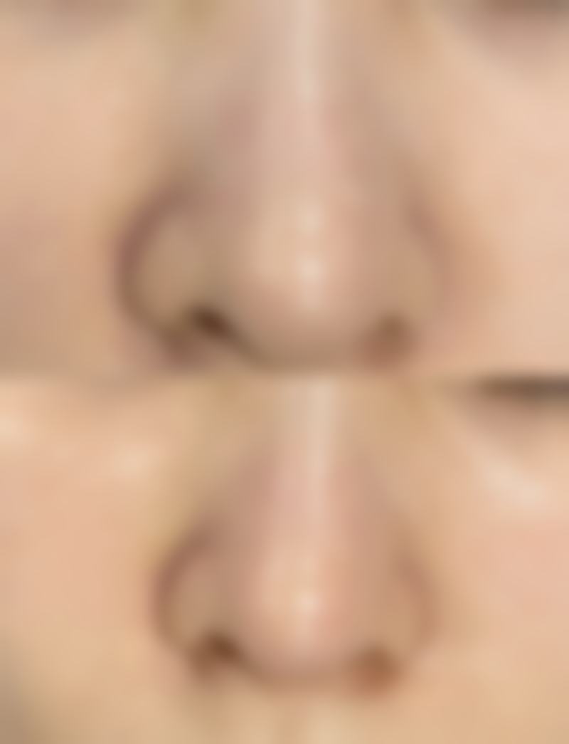 南昌佳美丽境医疗美容诊所实例参考