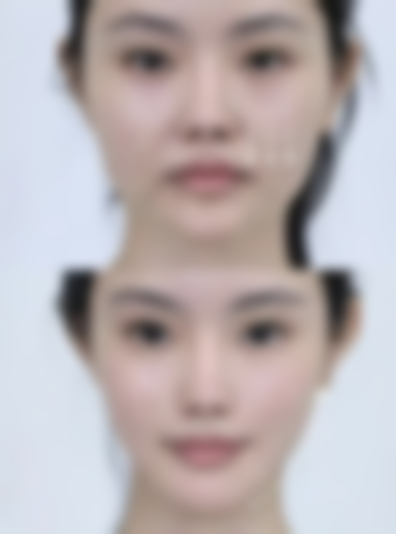 韩国特怡斯整形医院价格表（仅供参考）