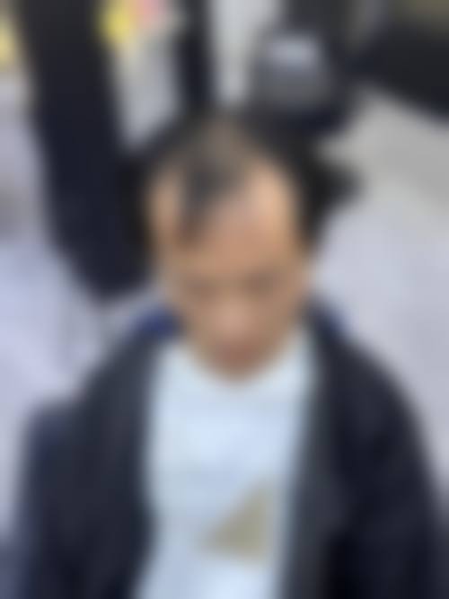 南昌雍禾植发医疗美容诊所价格表（仅供参考）