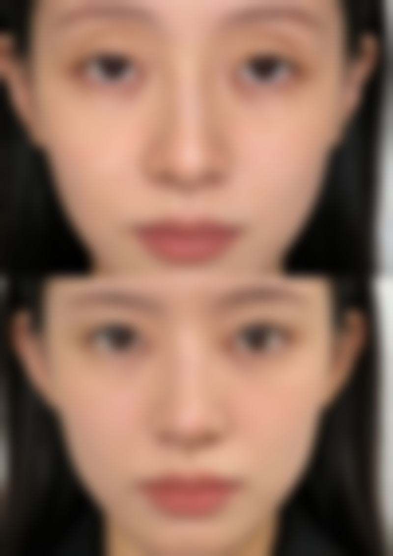 南充川北医学校附属医院整形美容科价格表（仅供参考）