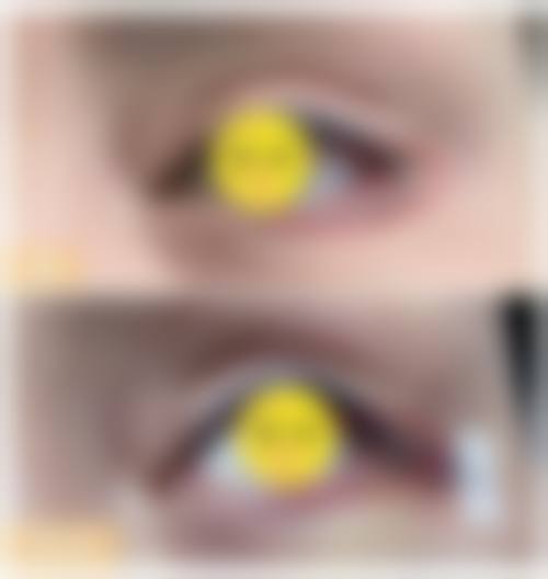 苍南韩星医疗美容医院实例参考