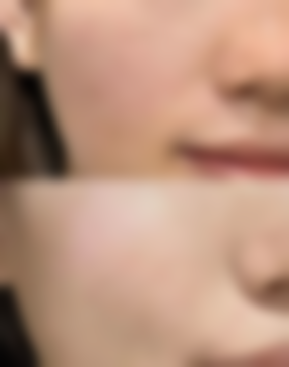 长沙丽恩整形医院实例参考