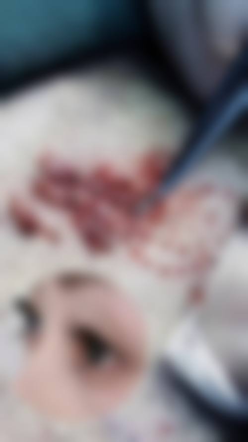 四川遂宁西西医疗美容实例参考