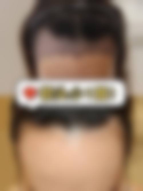 四川遂宁西西医疗美容价格参考