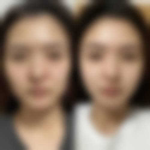 四会华美医疗美容医院价格表(仅供参考)