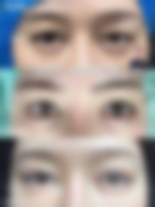 四川遂宁西西医疗美容怎么预约？