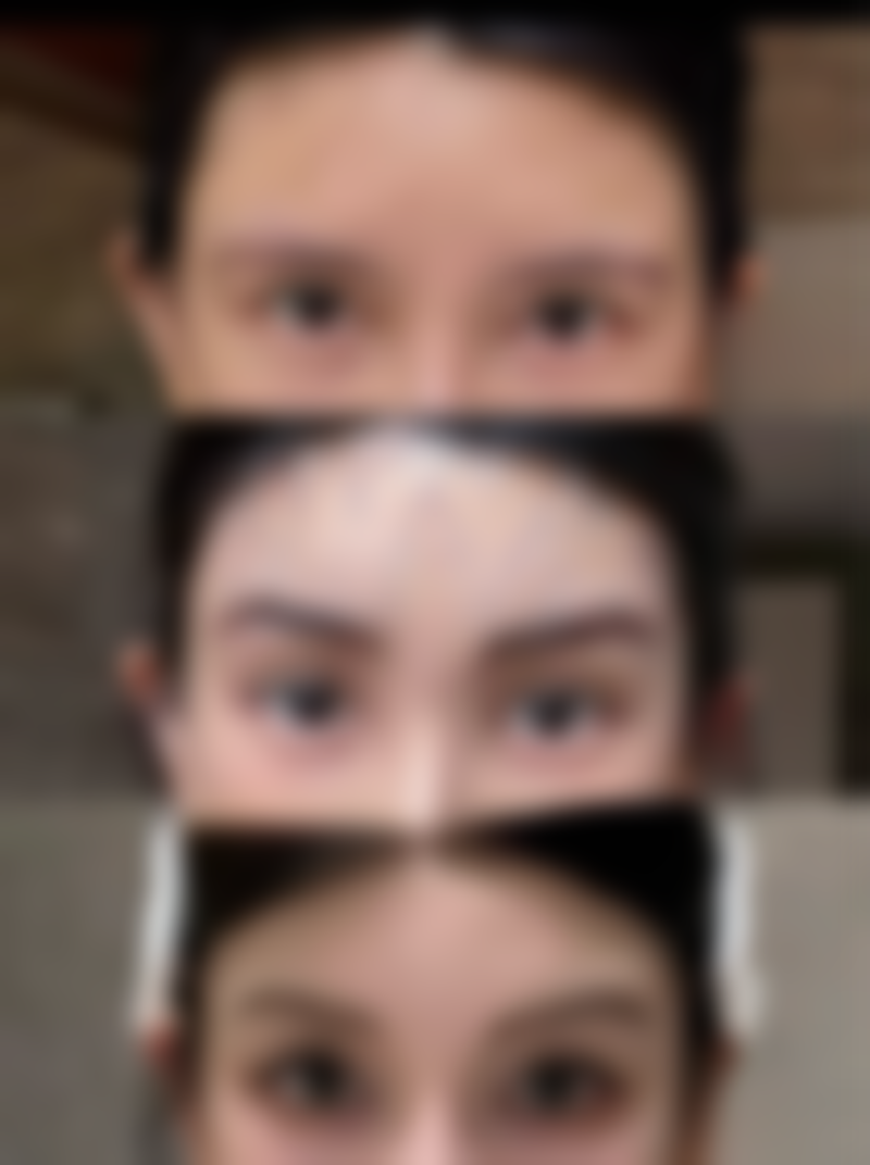 东莞缔美整形美容医院核心项目