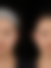 襄阳伊尔美医疗美容门诊部实例参考