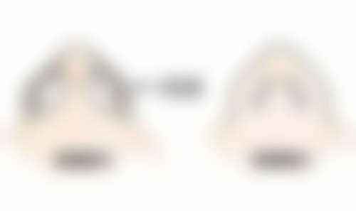 毕节发博士植发医院正规吗？看资质