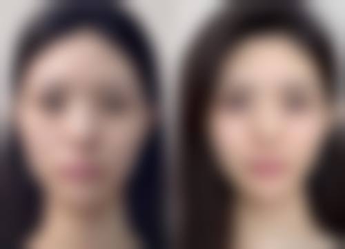 北京瑞丽舍医学美容机构价格表(仅供参考)