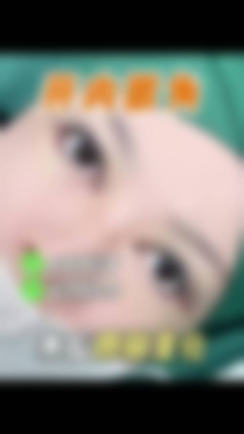 长沙岳麓区悦美医院实例参考