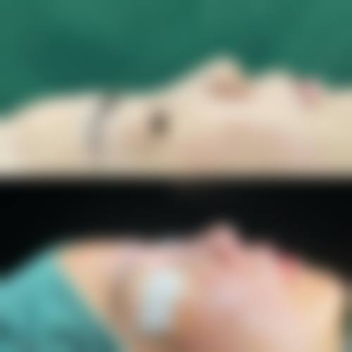 兰州市明伦医疗美容门诊部怎么预约？