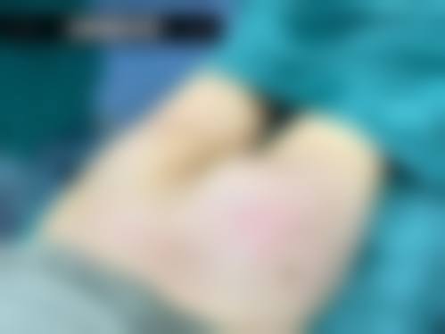 秦皇岛梵时光医疗美容诊所实例参考