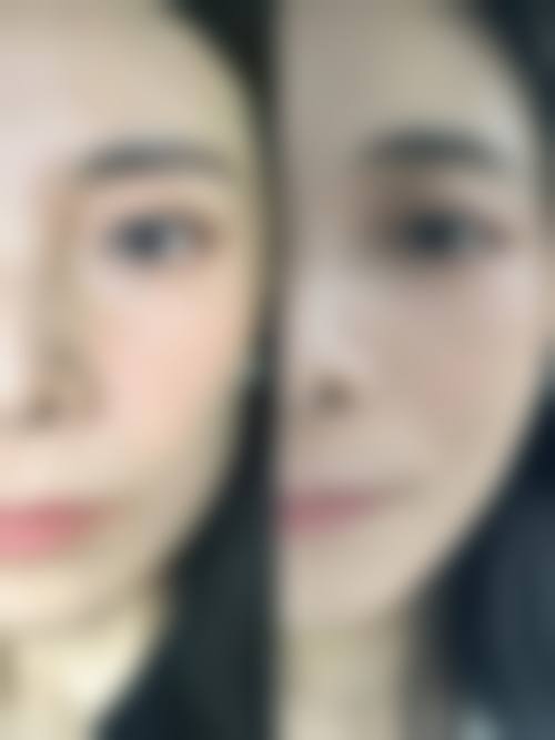 汕头伊雅医疗美容诊所价格表（仅供参考）