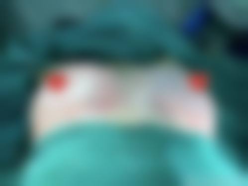 信阳禾美医疗美容门诊部怎么预约?