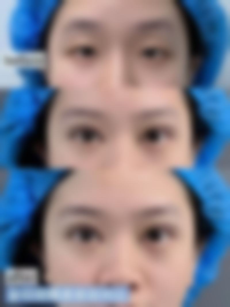 赣州芳华（明珠丽格）医疗美容医院价格表（仅供参考）