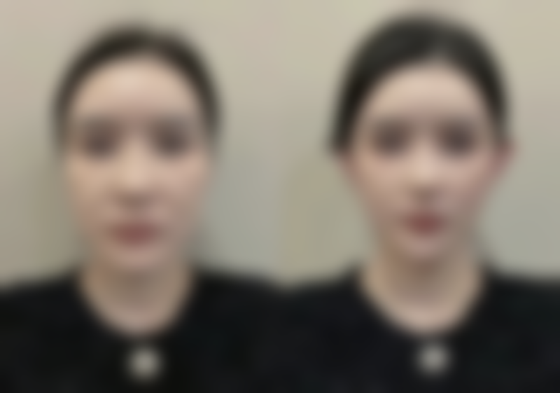 北京蓝海中医医院医疗美容科价格表（仅供参考）