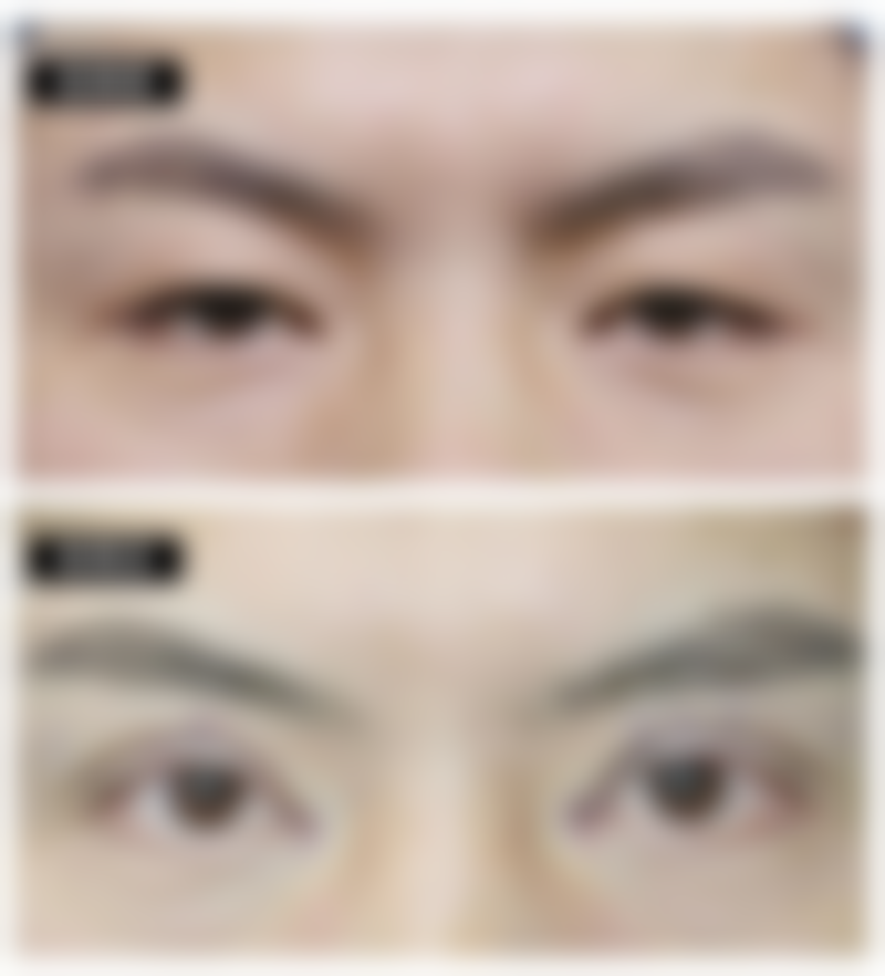 杭州金红医疗美容诊所实例参考