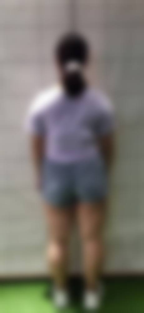 北京瑞丽天承整形医院实例参考