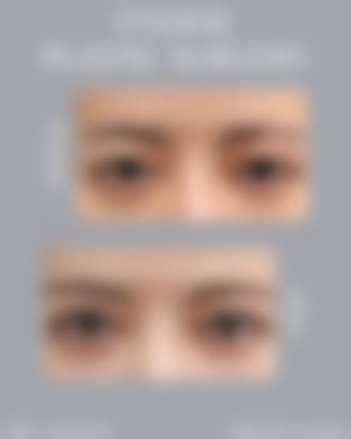 长春铭尚整形医院核心项目