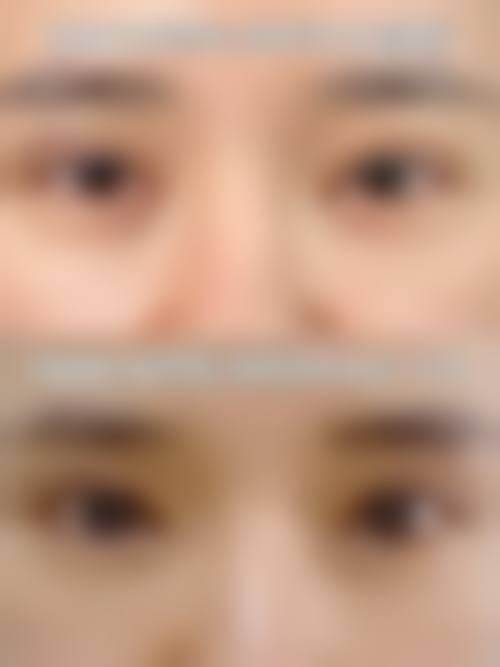 三河娜么美医疗美容诊所实例参考