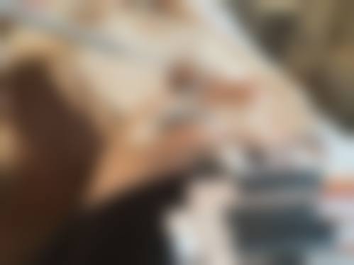 南京科发源植发医院实例参考