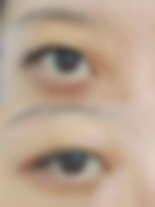 南京科发源植发医院核心项目