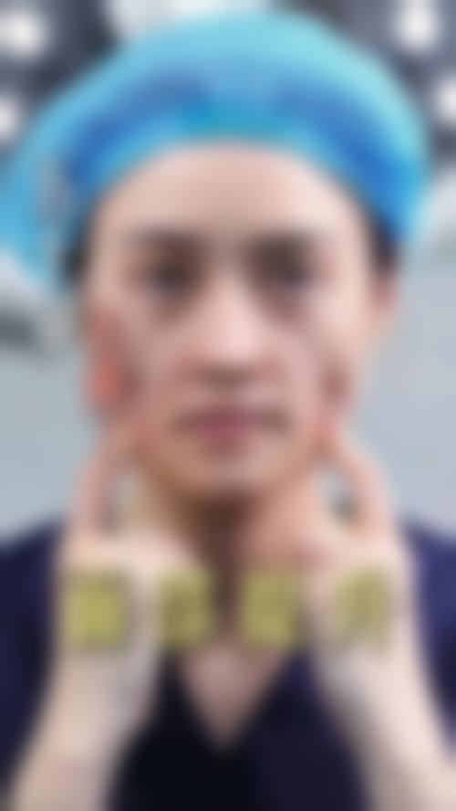 石家庄天宏医疗美容医院(原巍名仕)实例参考