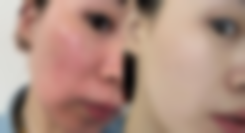 Tegoshi Clinic怎么预约?