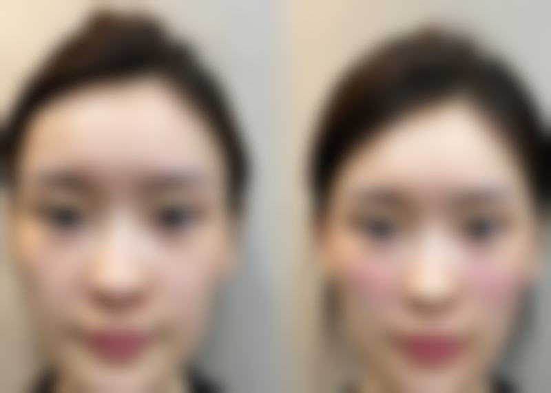 武汉中盛整形美容怎么预约？