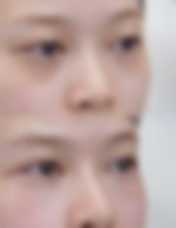 三河娜么美医疗美容诊所怎么预约?