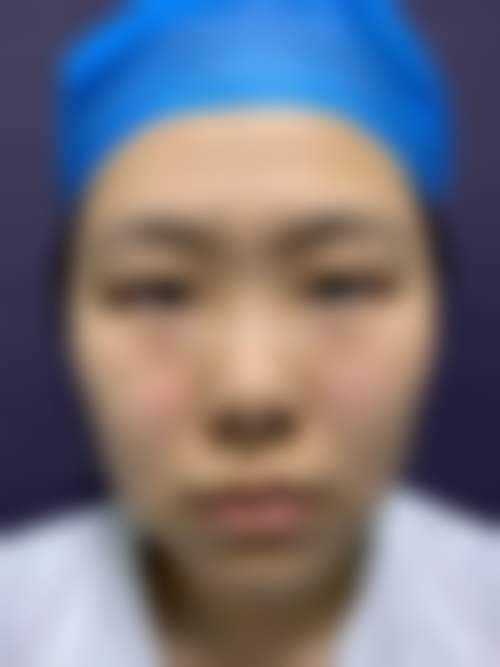 西安普莱蒂医疗美容门诊部价格表（仅供参考）