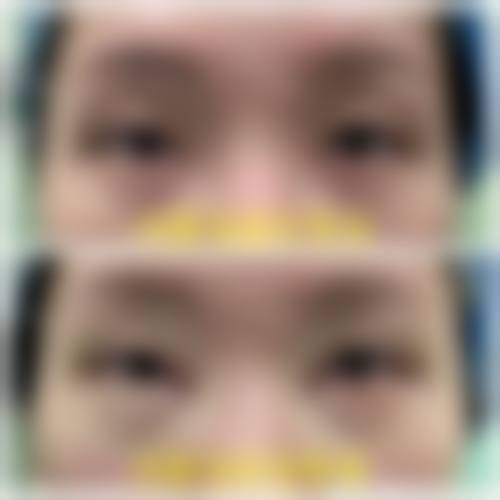 绍兴市妇幼保健院整形美容科核心项目