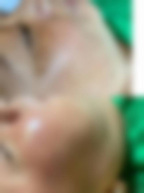 绍兴市妇幼保健院整形美容科价格表(仅供参考)