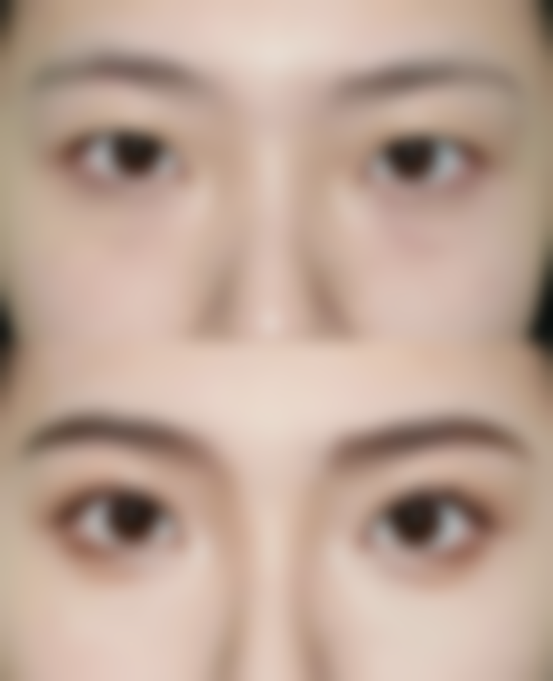 太原精灵整形医院核心项目