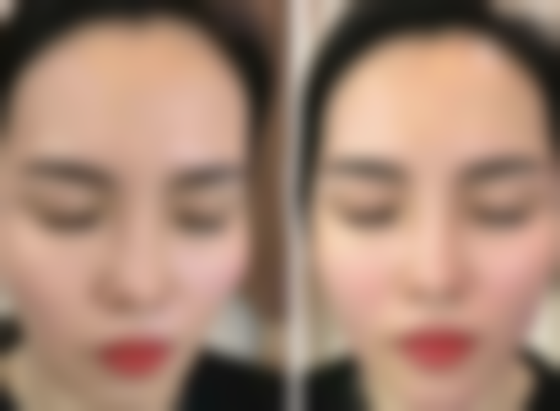 海口氧颜蔻美咖整形医院价格表（仅供参考）