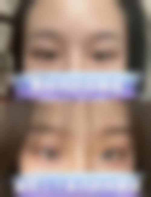 南宁美初医疗美容门诊部价格表（仅供参考）