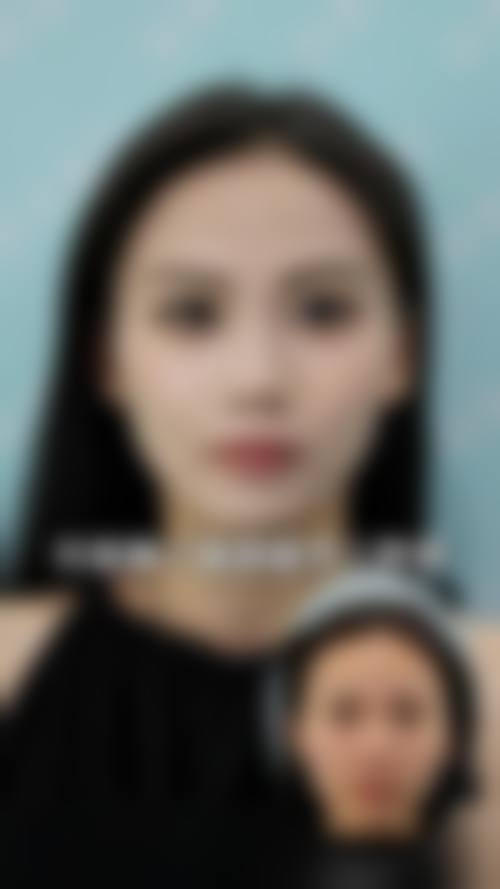 北京焕誉医疗美容医院价格表（仅供参考）