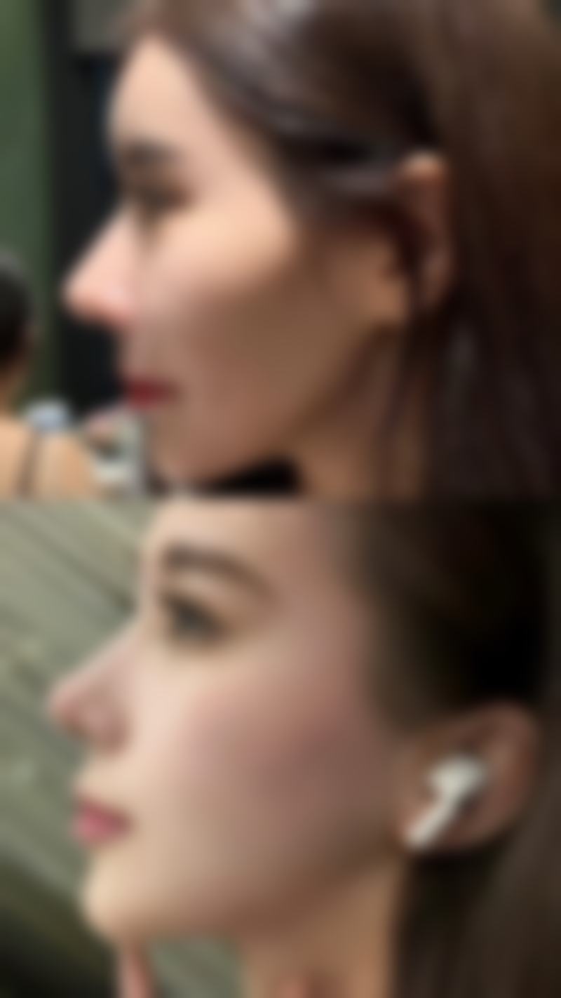 深圳黛颜（韩国MIND）整形怎么预约？